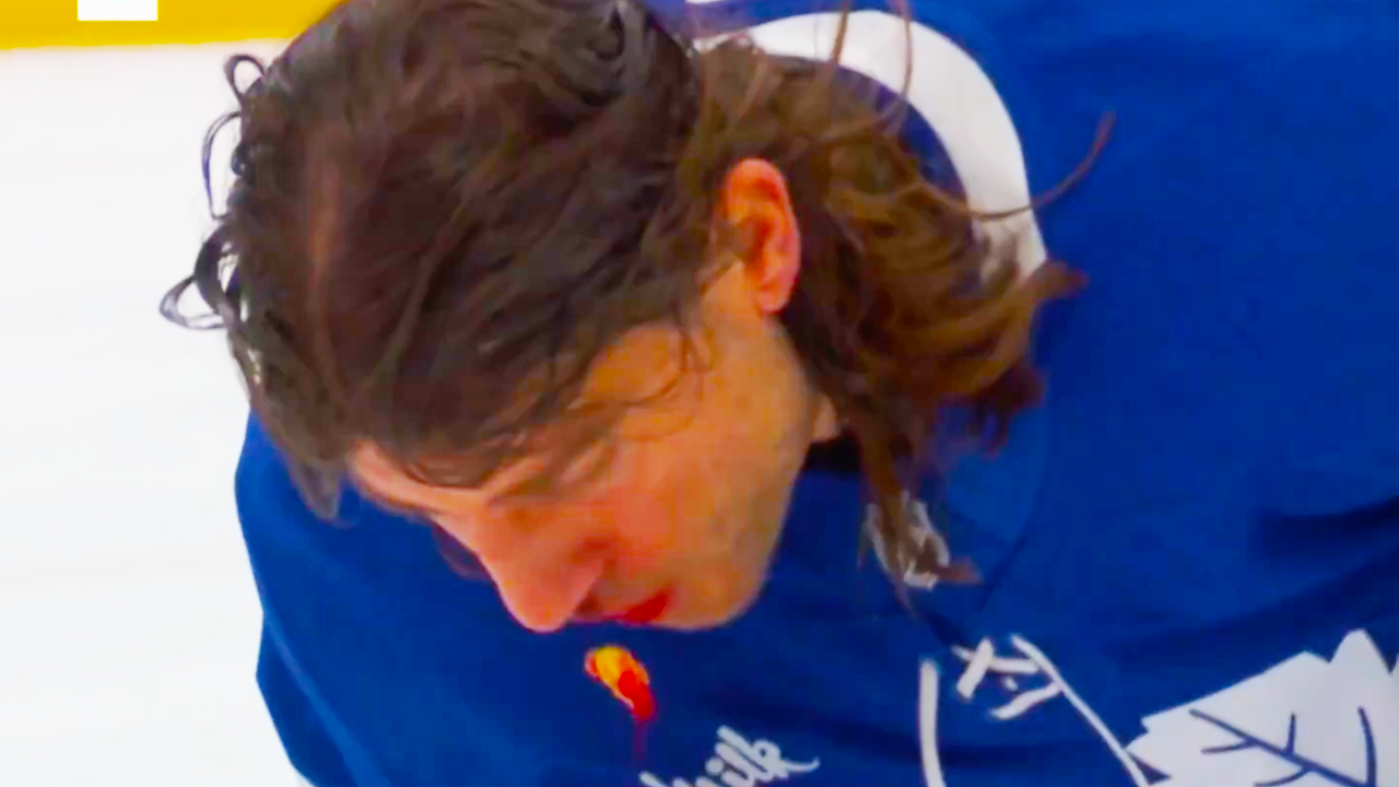 Chris Tanev spits out a tooth after taking a puck to the face | Toronto Maple Leafs vs New York Islanders 2024 NHL Highlights