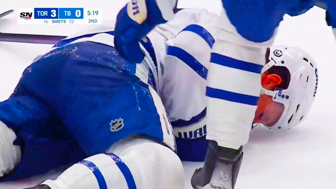 Jake McCabe Leaves Game After Taking A Puck To The Face | Maple Leafs vs Lightning 2024 NHL Highlights