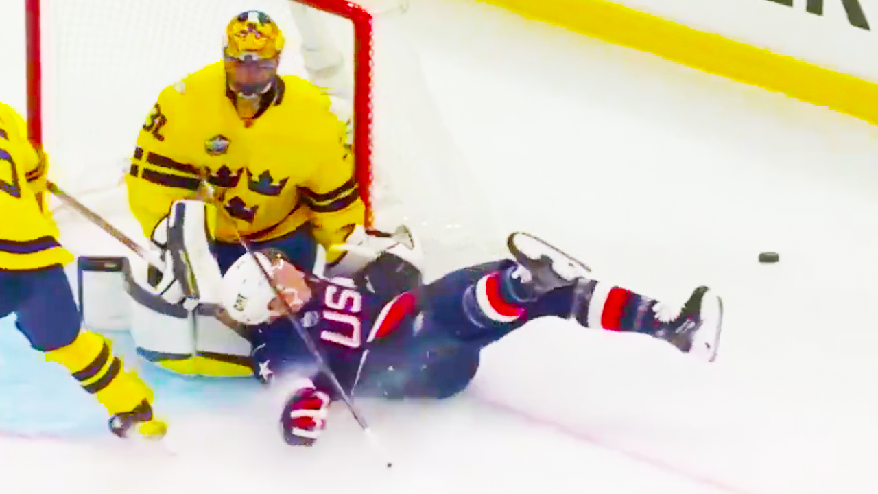 Brady Tkachuk Injury Crashes into Net | USA vs Sweden 4 Nations Face Off 2025 NHL Highlights