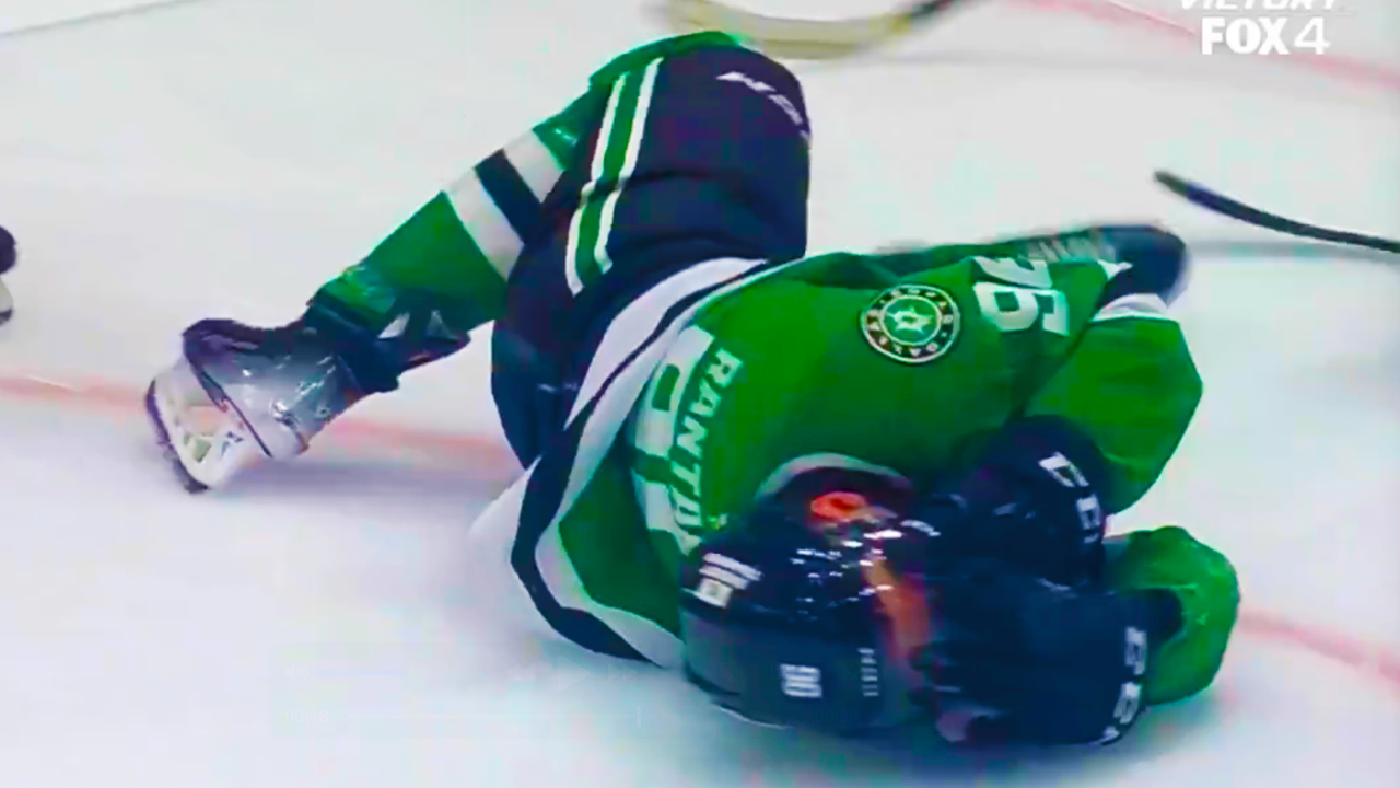 Mikko Rantanen Injury takes Puck to Face | Dallas Stars vs Minnesota Wild 2025 NHL Highlights
