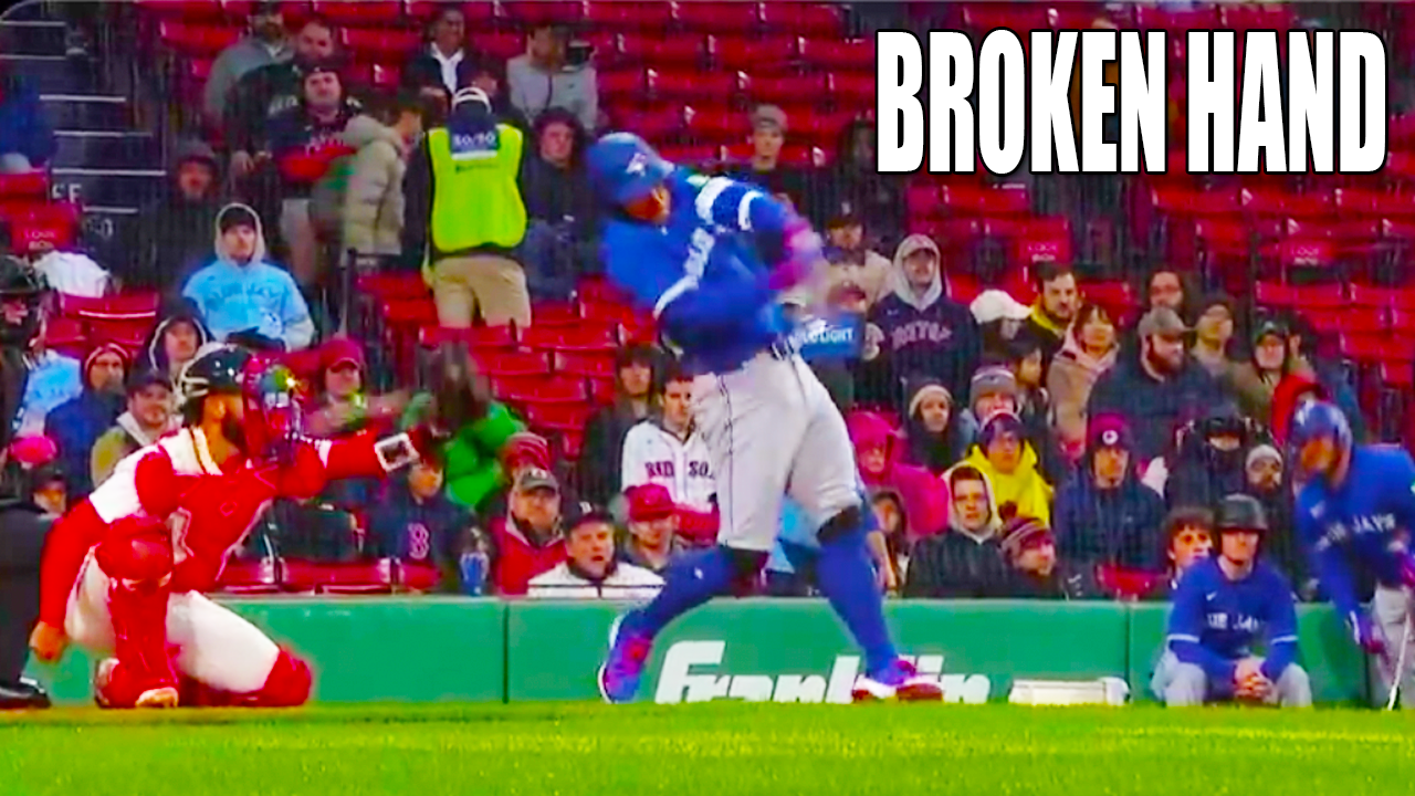 Connor Wong Injury Broken Hand from Catcher’s Interference on George Springer | Toronto Blue Jays vs Boston Red Sox 2025 MLB Highlights