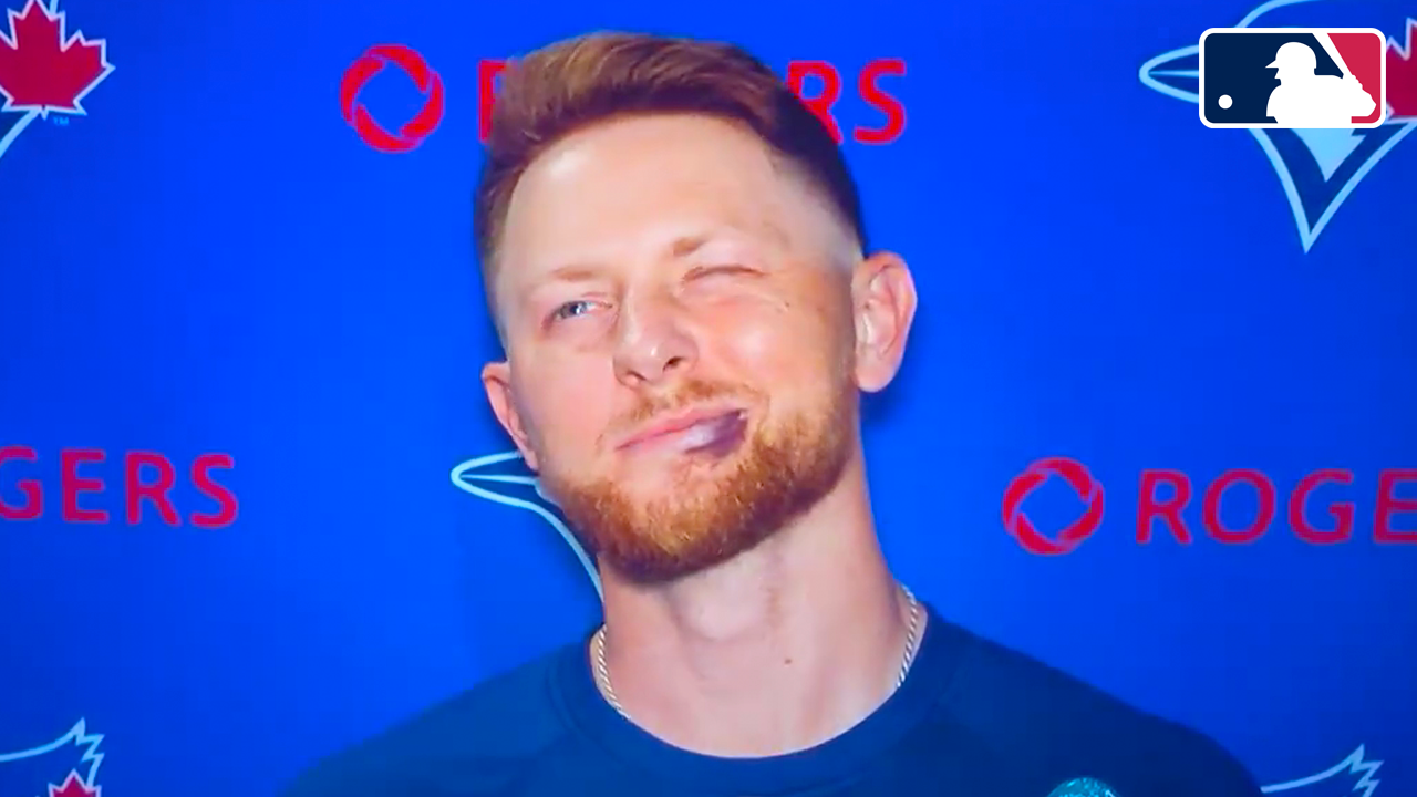 Max Scherzer “Hit” Eric Lauer in the mouth giving him 6 stitches | Toronto Blue Jays 2025 MLB Highlights