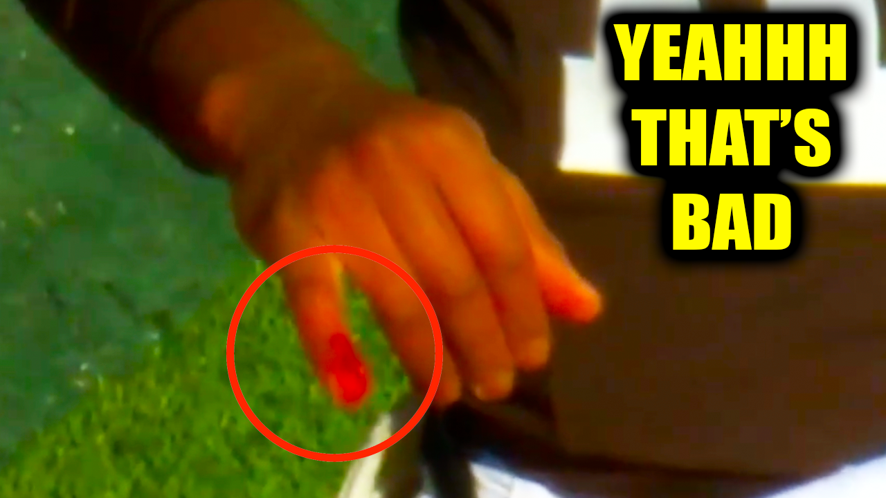 Shedeur Sanders Finger BLEEDING & Nose Injury | Buffalo Bills v Cleveland Browns 2025 NFL Highlights