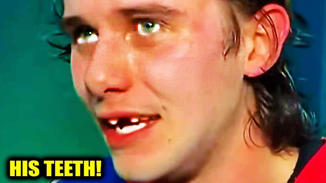 Jack Hughes Missing Teeth Post Game Interview | Team USA vs Team Canada 2026 Men’s Ice Hockey